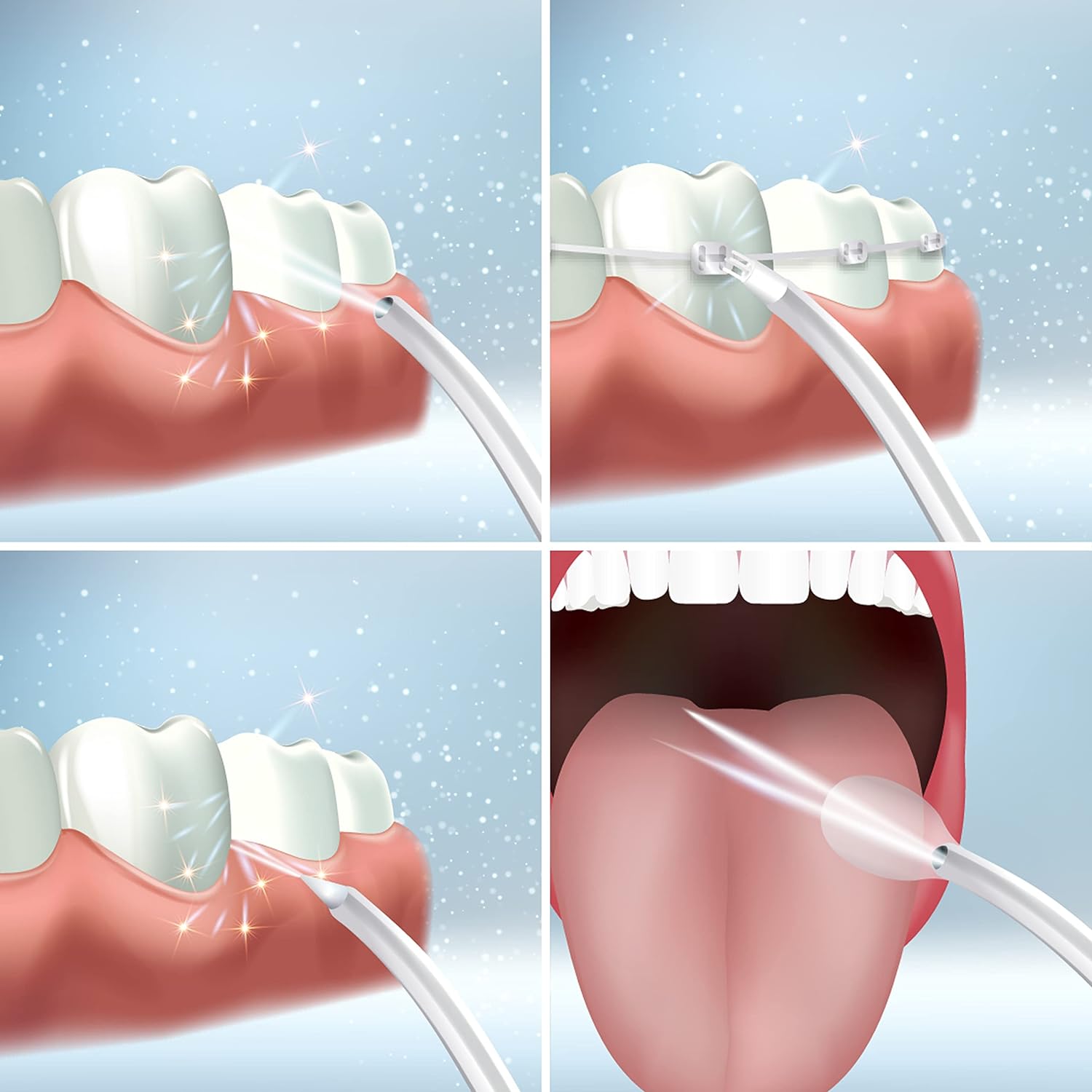 Unidad Extra Irrigador bucal ultrasónico