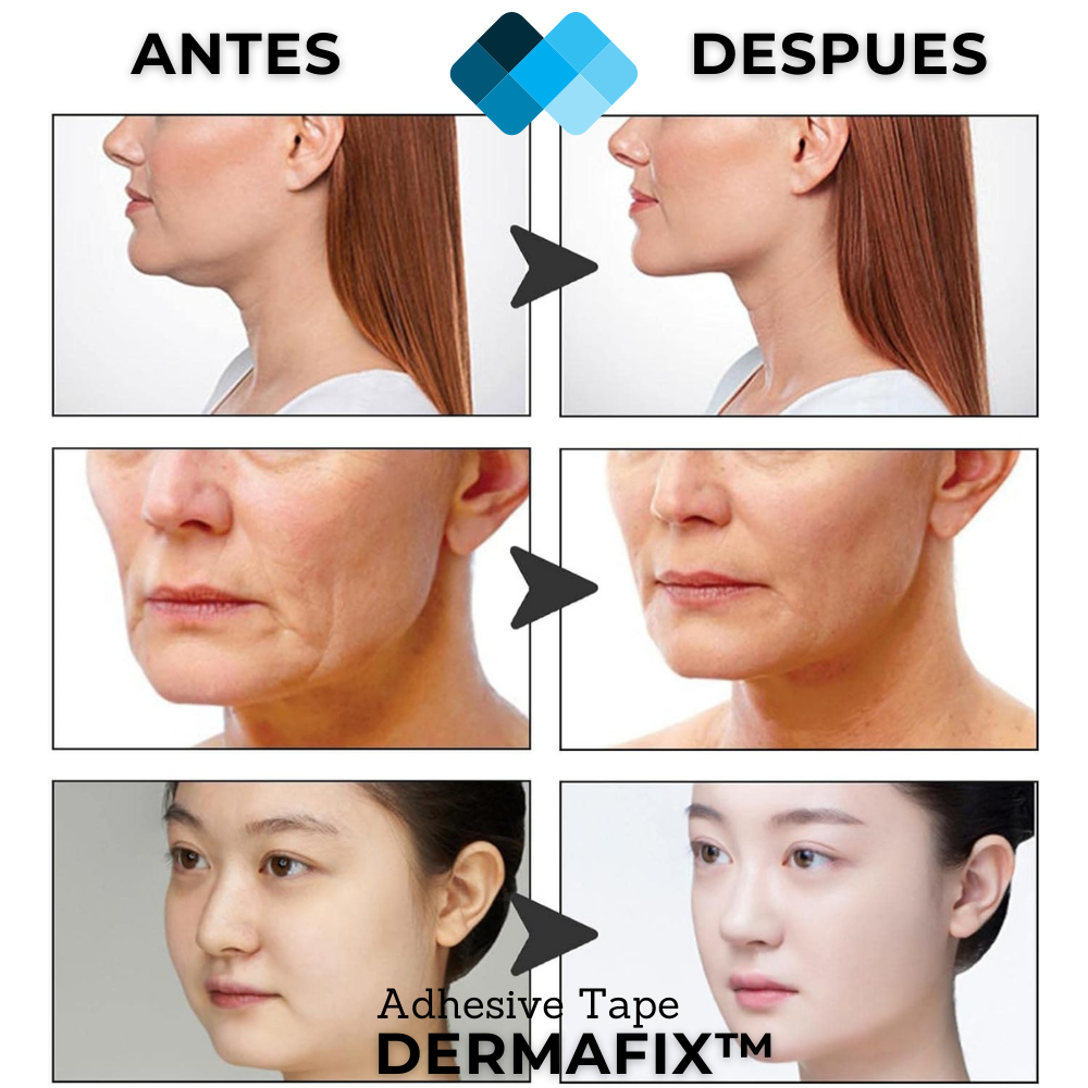 Fijación Dermatológica Avanzada - DermaFix™ Adhesive Tape