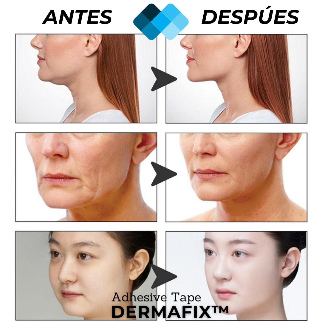 Tiras Lifting facial Anti-Arrugas y Rejuvenecedoras Transparentes